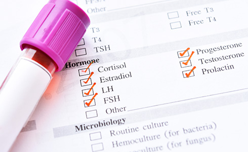 Hormone Testing Boca Raton FL